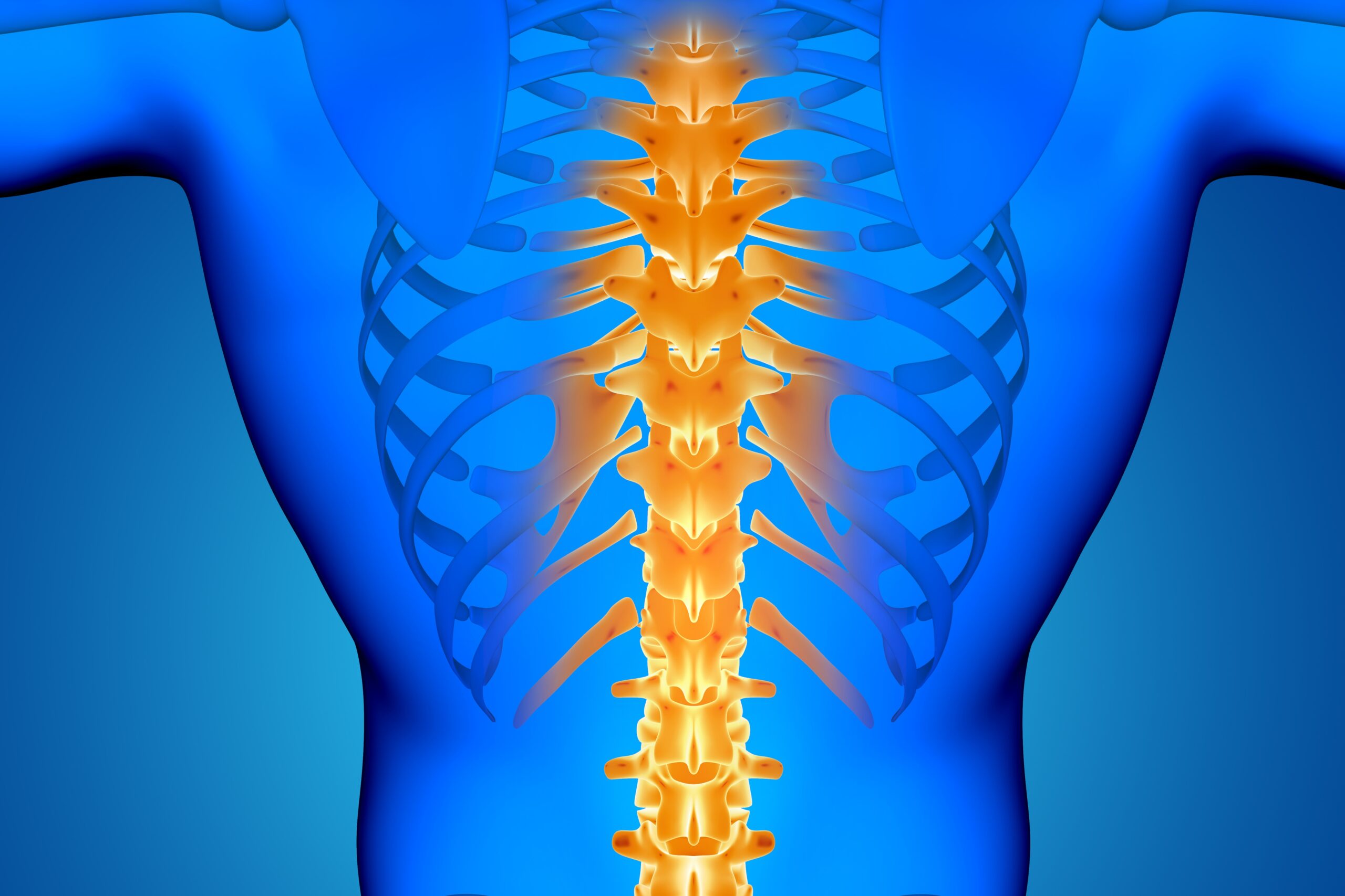 Como supero minhas dores de coluna sem cirurgia e evitando ao máximo os medicamentos